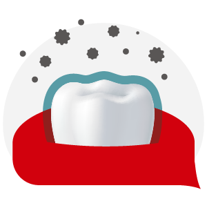 Pencegahan Gigi Berlubang